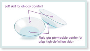 hybrid lens